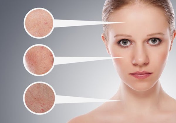 Kem trị nám giúp làm mờ và loại bỏ đốm nám trên da