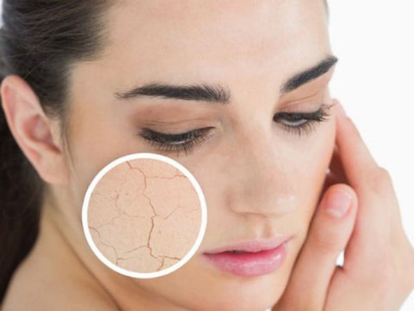 Cách chọn sữa rửa mặt cho da khô