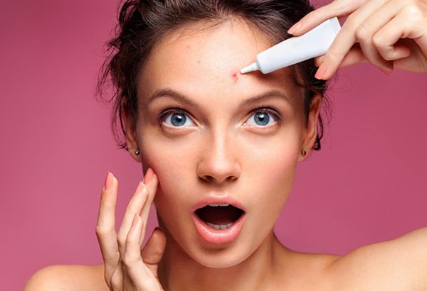 Chọn kem trị mụn có thương hiệu uy tín